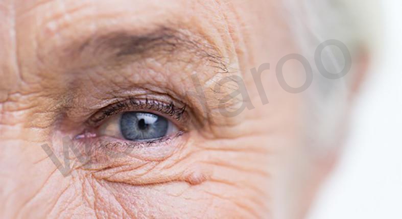 ارتقا سطح بینایی با بهره گیری از خواص مولتی ویتامین ها 