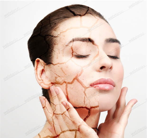 راهکارهای ساده برای پیشگیری و درمان خشکی پوست 