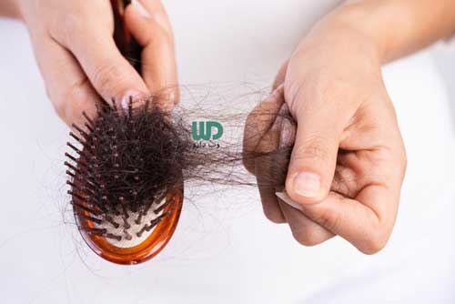 ریزش مو، از نشانه های کم خونی ناشی از فقر آهن