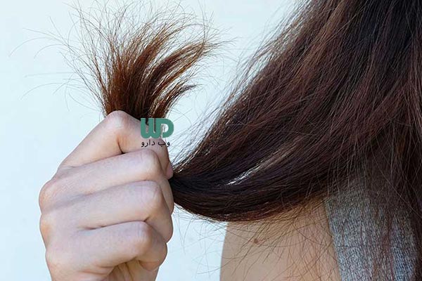 خشکی مو در اثر استفاده از شامپو سولفات دار